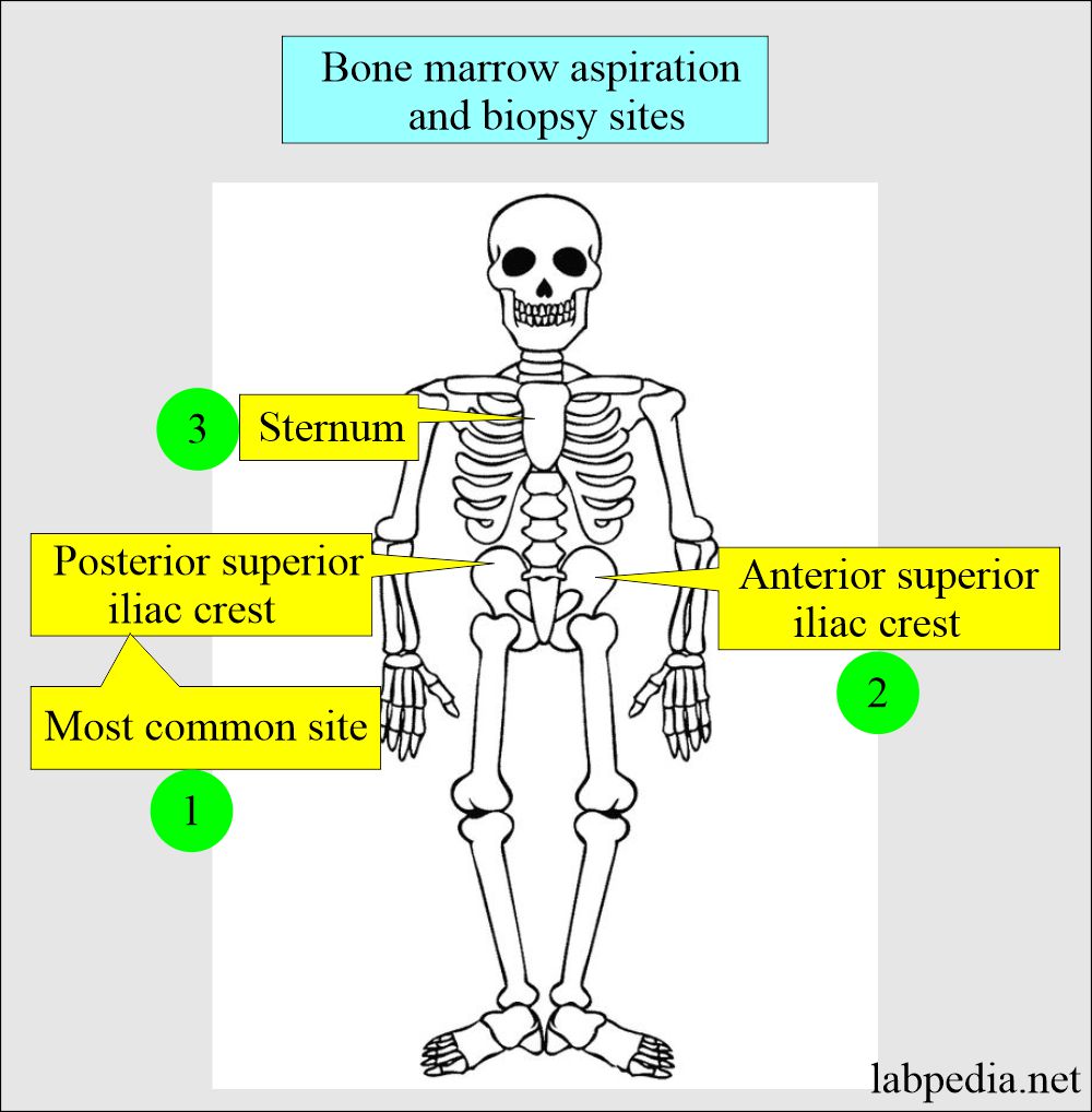 Bone marrow aspiration sites