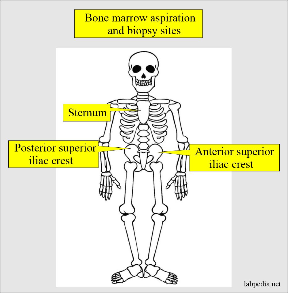 Bone marrow aspiration sites