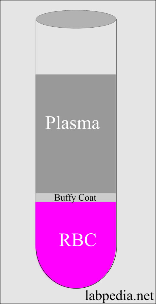 Blood sample Types, Anticoagulants, Preservatives, Adverse effects of