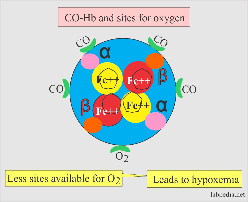 Carboxyhemoglobin (CO-Hb), Carbon monoxide (CO) poisoning