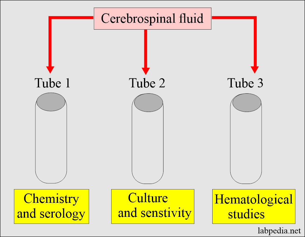 Summary of CSF findings In Various Diseases: CSF collected into three test tubes