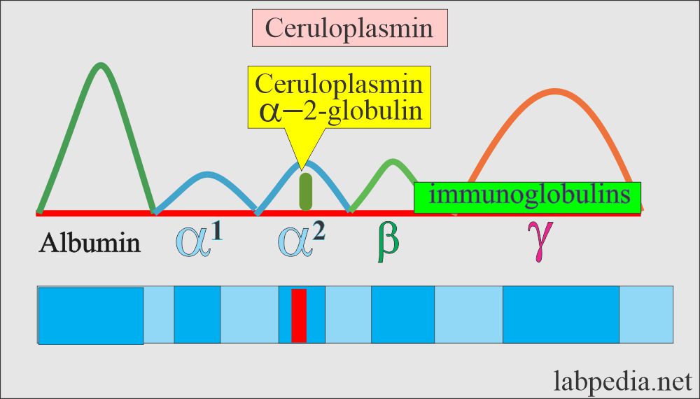 Ceruloplasmin on electrophoresis is present in alpha2-globulin
