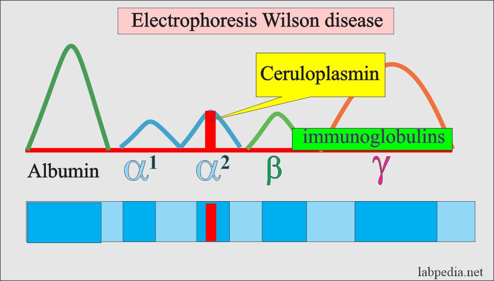 Ceruloplasmin electrophoresis
