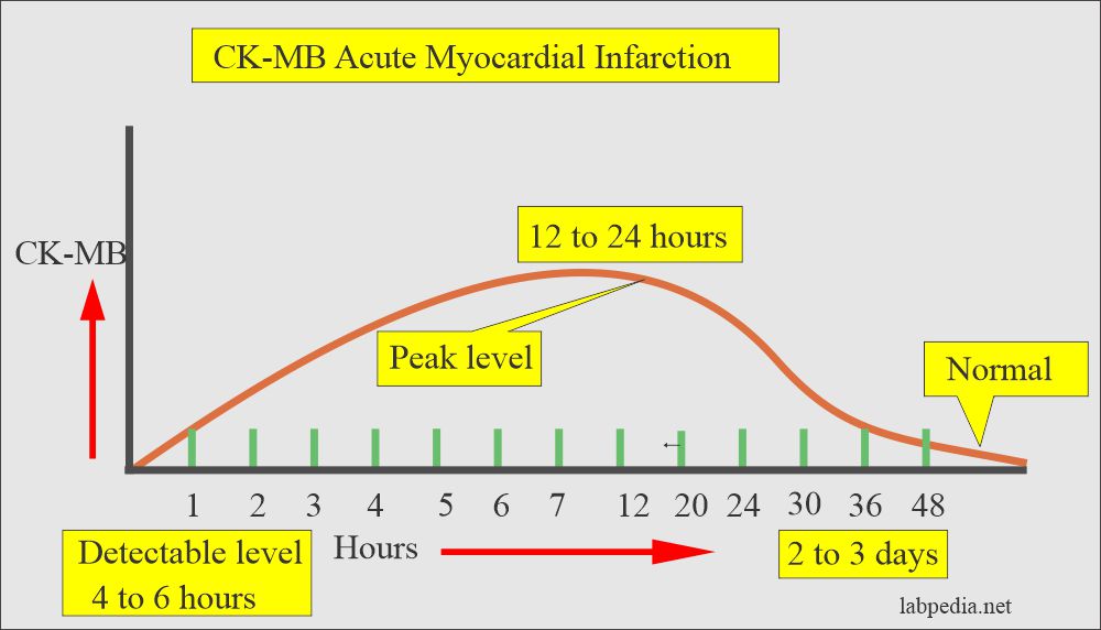 CK-MB level in acute myocardial infarction