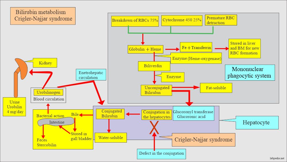 Crigler Najjar Syndrome and bilirubin metabolism 