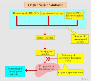 Crigler-Najjar Syndrome - Labpedia.net