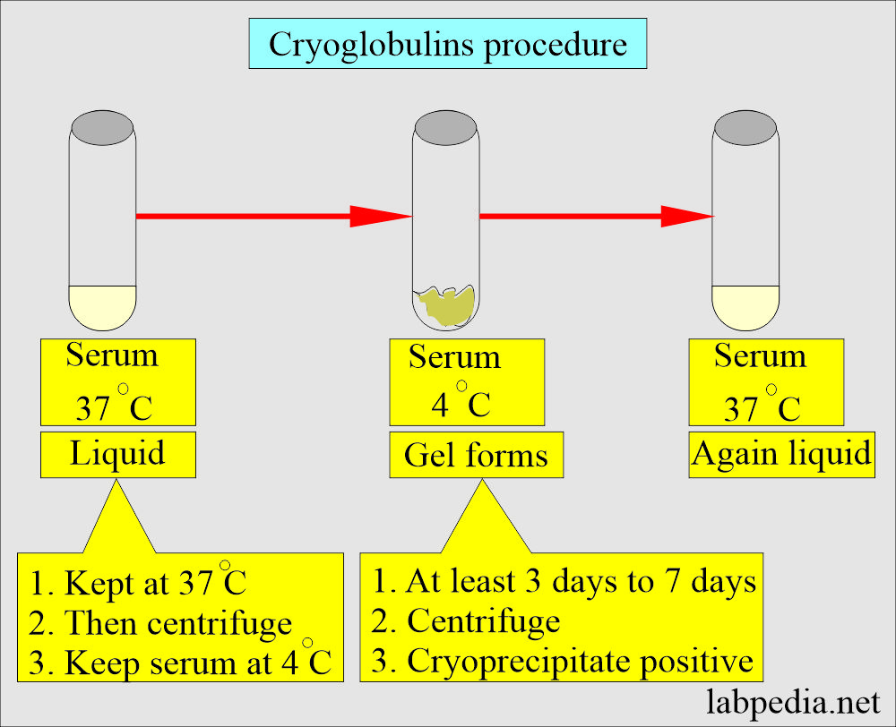 Cryoglobulin procedure