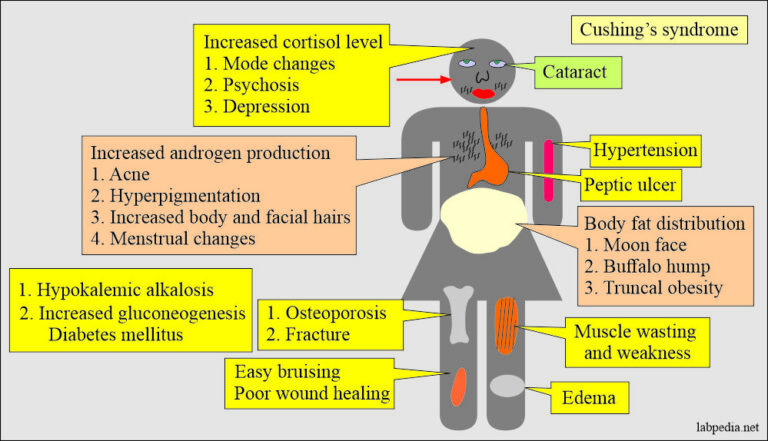 ACTH (Adrenocorticotropic Hormone), Cushing's Syndrome - Labpedia.net