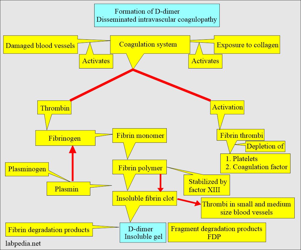 D-Dimer test: Disseminated coagulopathy (DIC) and D-dimer