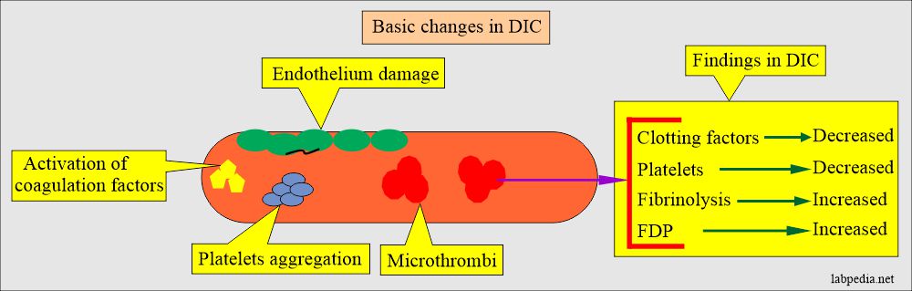 DIC pathogenesis