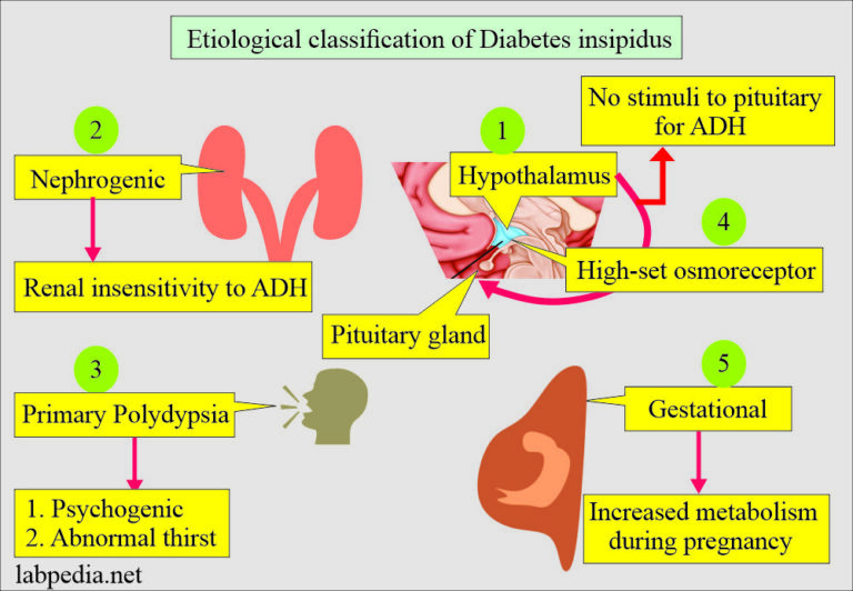 Diabetes Insipidus Classification 1 768x532 