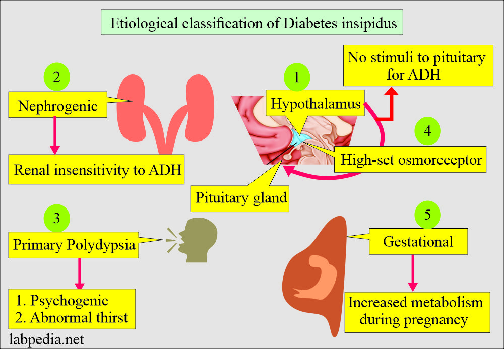 Antidiuretic Hormone