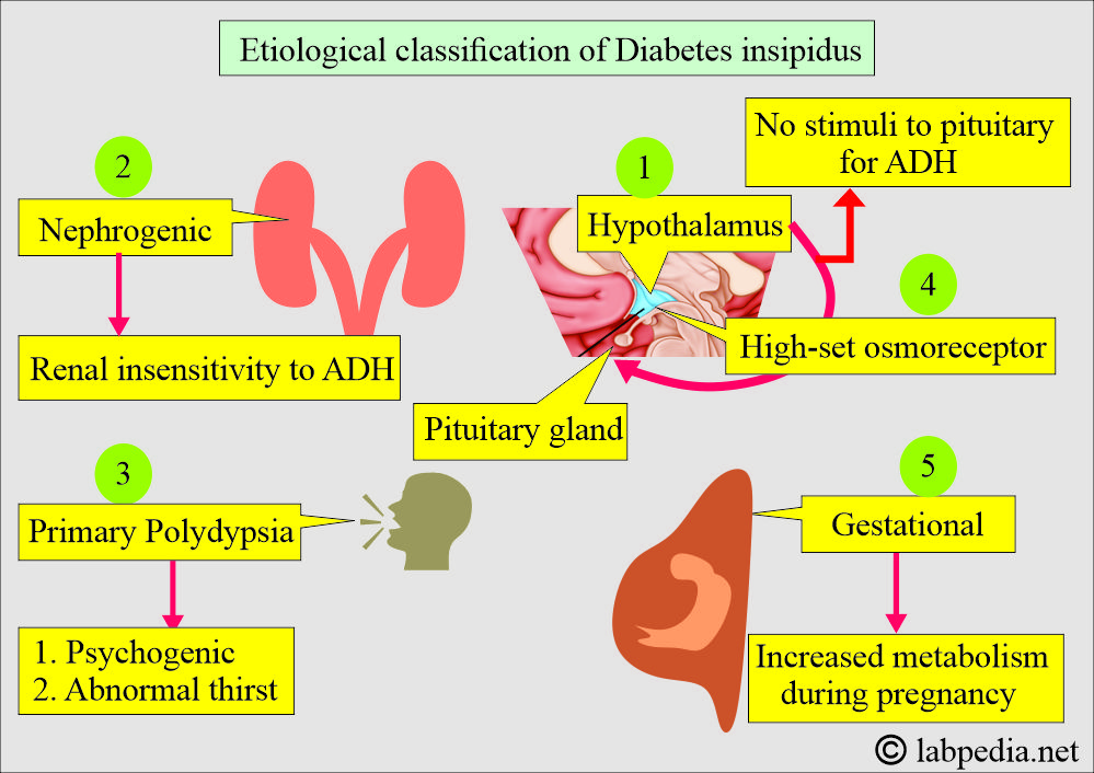 Diabetes insipidus classification