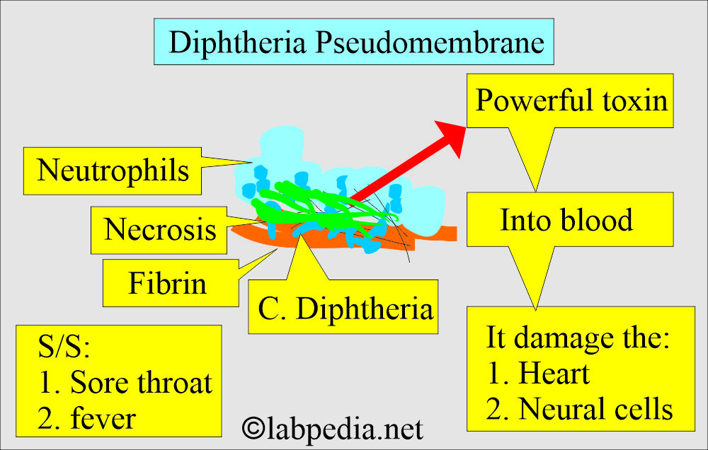 Diphtheria membrane