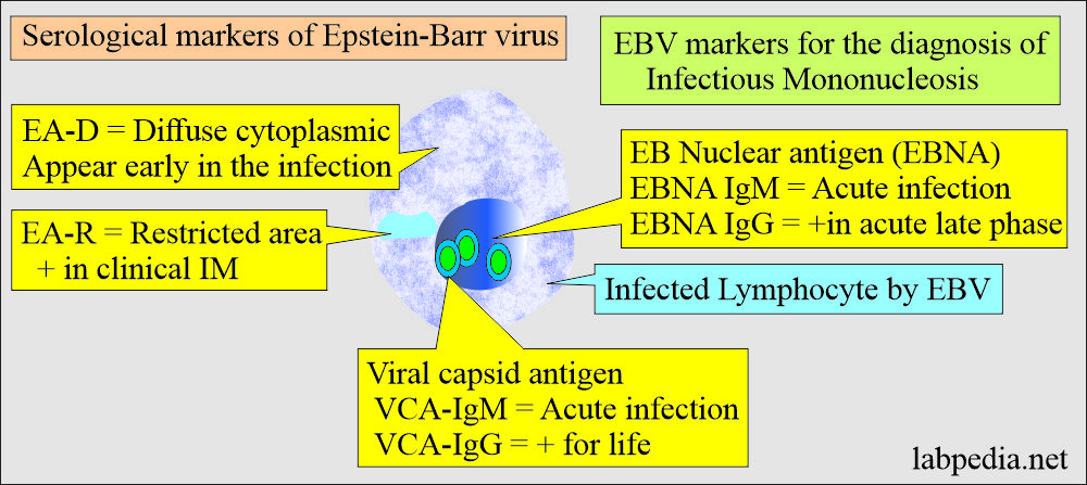 EBV serological markers for the diagnosis of Infectious Mononucleosis