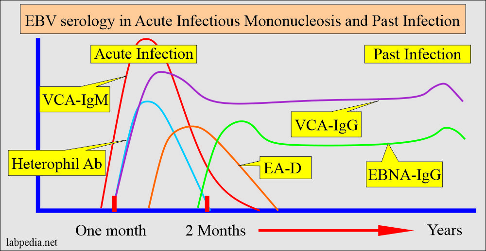 EBV serology in acute and past infection of Infectious Mononucleosis