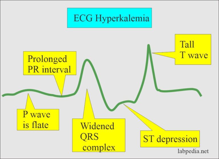 Potassium (K+) in blood and its significance