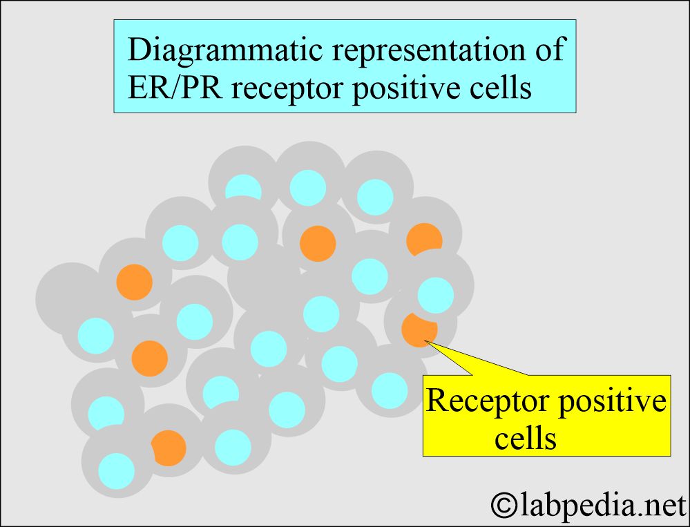 ER/PR positive cells demonstration