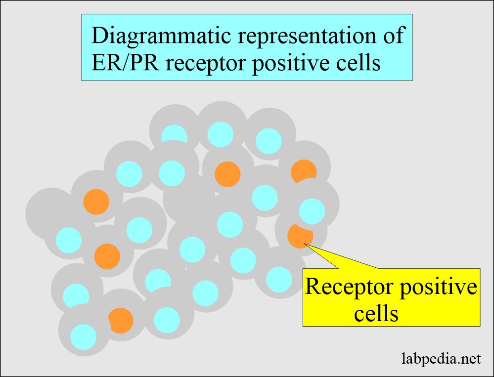 ER/PR positive cells