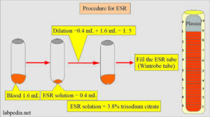 Erythrocyte sedimentation rate (ESR) solution and procedure