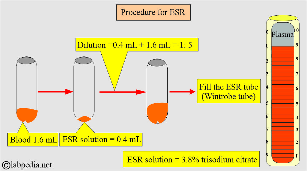 ESR procedure ESR procedure
