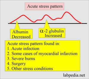 Immunoglobulin Electrophoresis, Immunoglobulins Pattern In Various ...