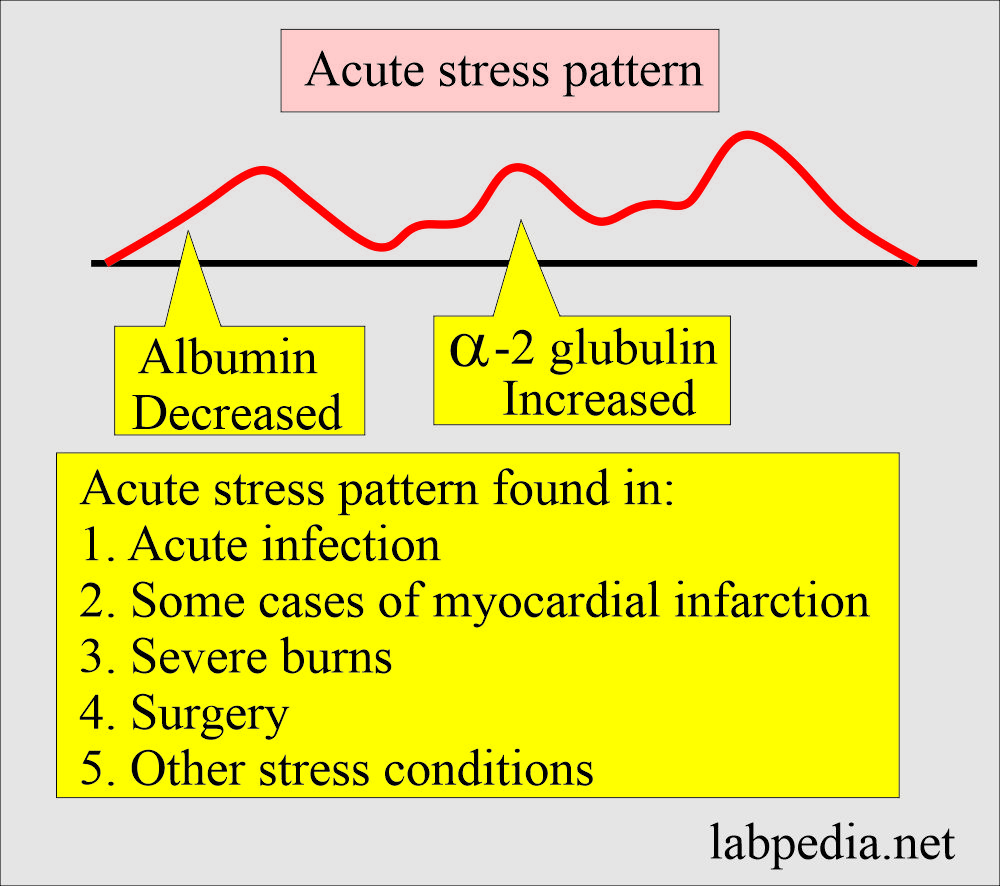 Electrophoresis acute pattern