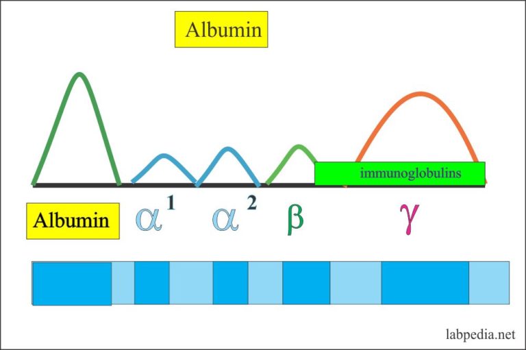 Immunoglobulin Electrophoresis (Ig), Immunoglobulins IgG, IgA, IgD, IgE