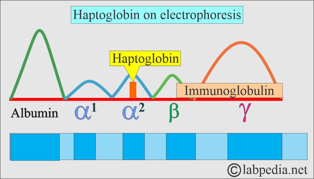 Electrophoresis of Haptoglobin picture Electrophoresis of Haptoglobin picture