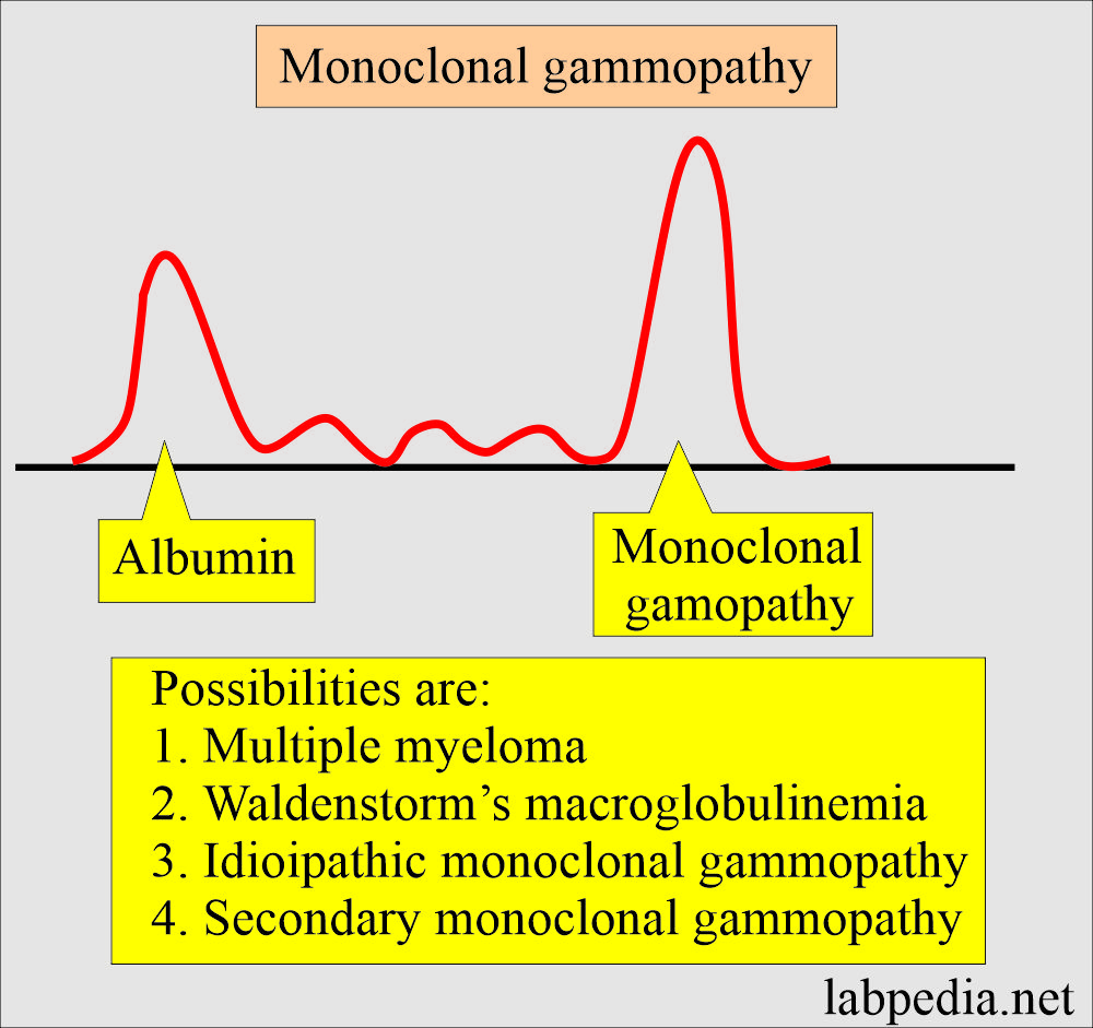 Electrophoresis polyclonal gammopathy