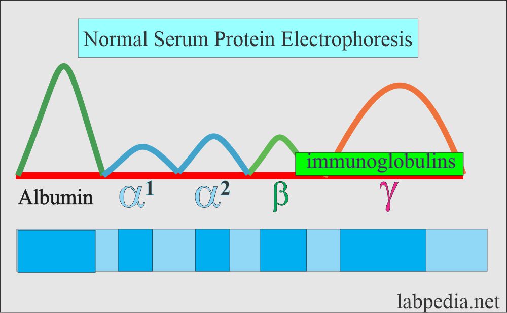 Serum Electrophoresis normal picture