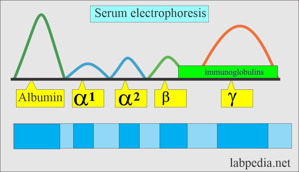 Immunoglobulin Electrophoresis: Electrophoresis serum