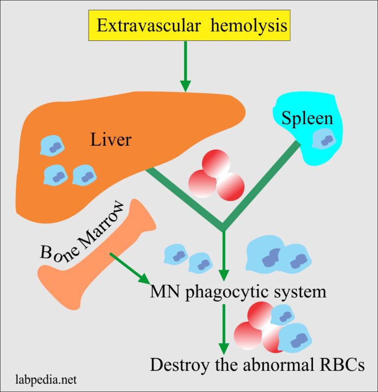 Anemia:- Part 8 - Hemolytic Anemias Classification, Autoimmune 