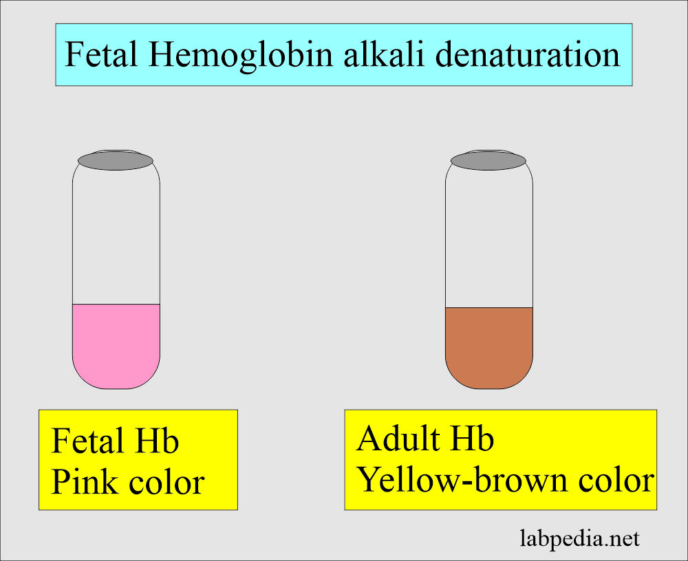 Fetal Hb alkali denaturation