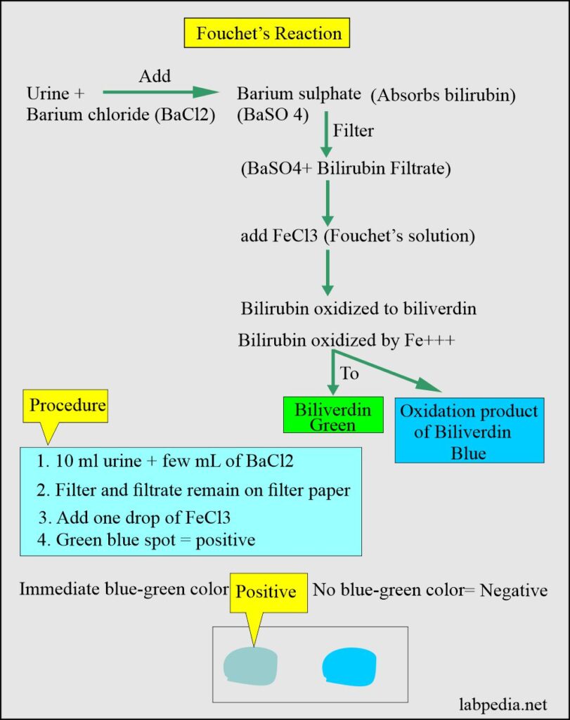 Urine For Bile pigments (Bilirubin, Urobilinogen, and Bile Salts