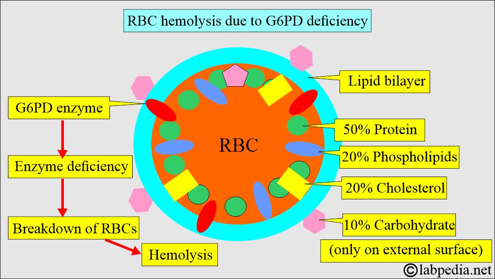 G6PD deficiency leading to hemolysis G6PD deficiency leading to hemolysis