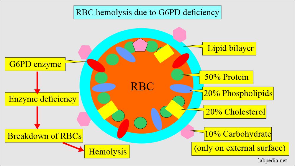 G6PD leading to hemolysis of RBCs