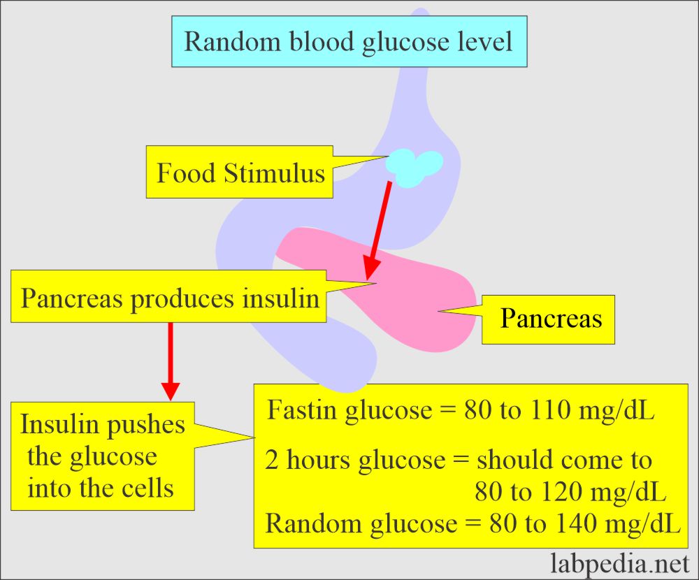 Glucose random level