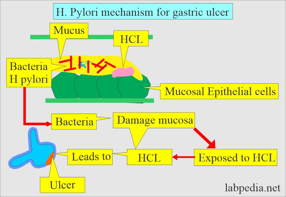 Urea Breath test for pylori: H pylori present in the mucus of the stomach