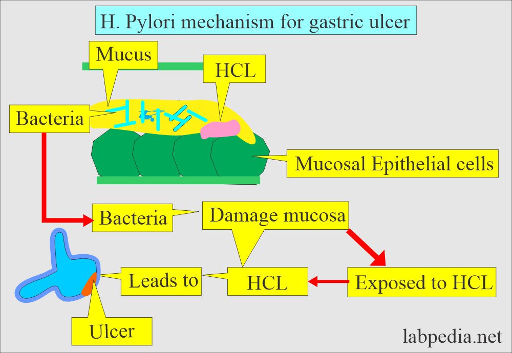 erm-den-gesunder-menschenverstand-analog-h-pylori-ulcer-mechanism-gans