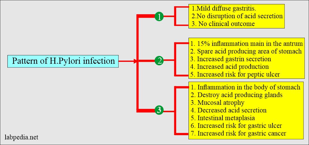 Urea breath test: H. Pylori infection pattern