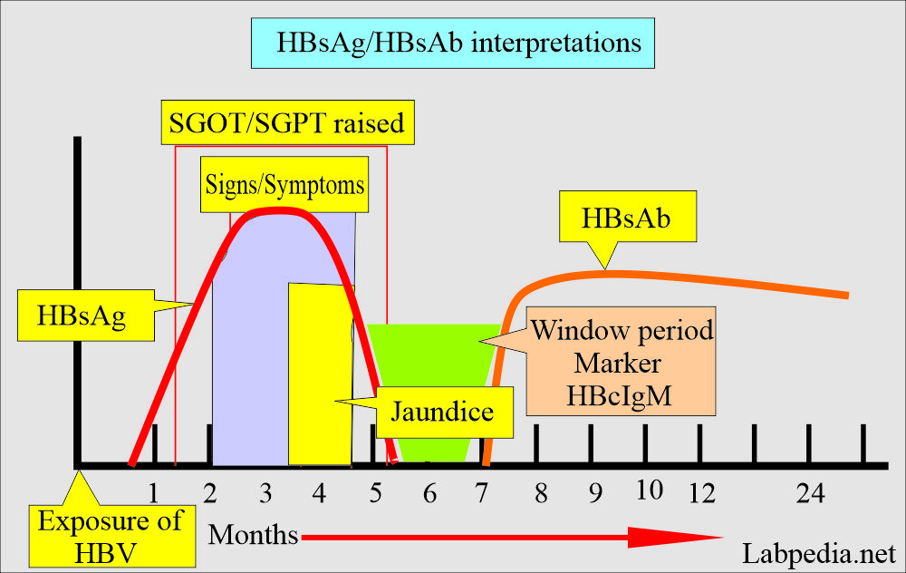 Hepatitis B virus (HBV) showing HBs antigen and antibody