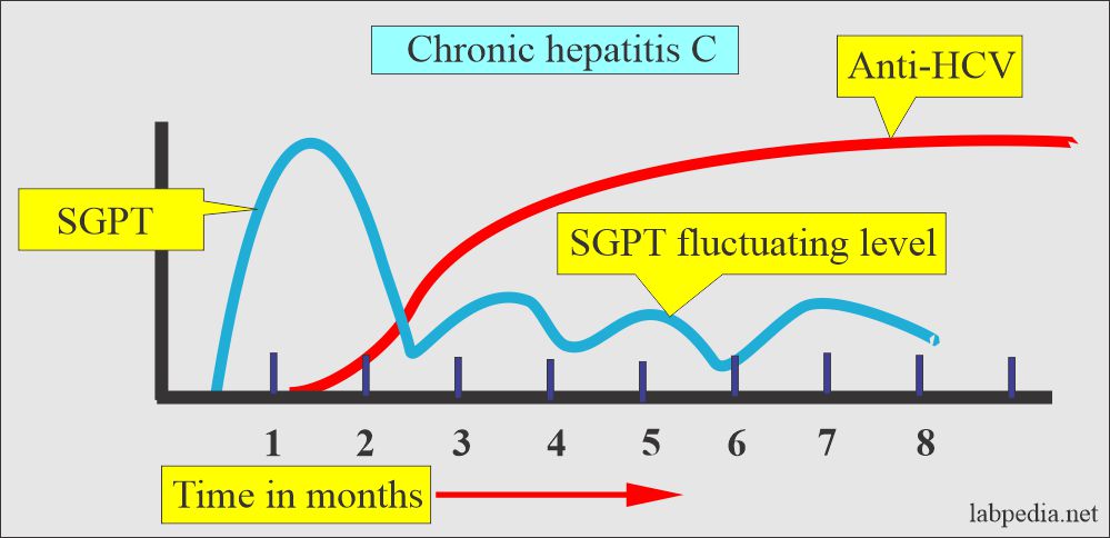 Hepatitis C Virus (HCV) in chronic hepatitis (SGPT)