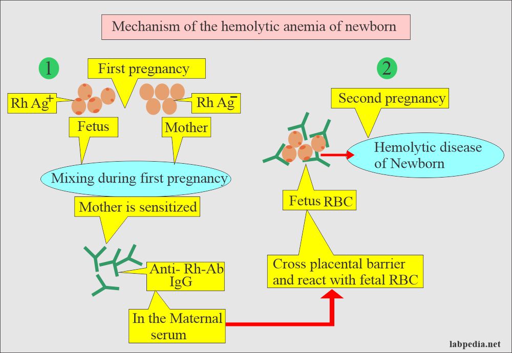 Mechanism of the hemolytic disease of the newborn