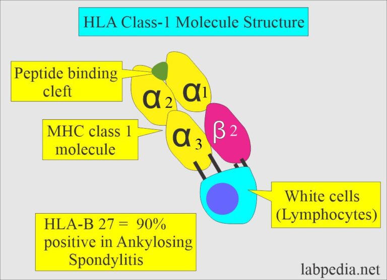 Human Leucocyte Antigen B27 (HLA B27), Interpretations