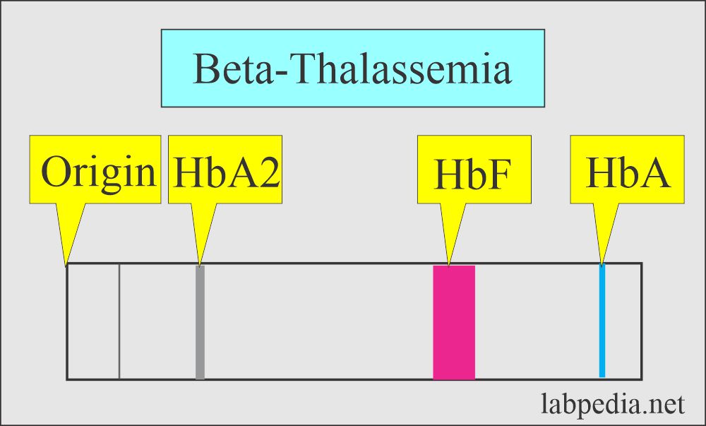 Beta-Thalassemia electrophoresis