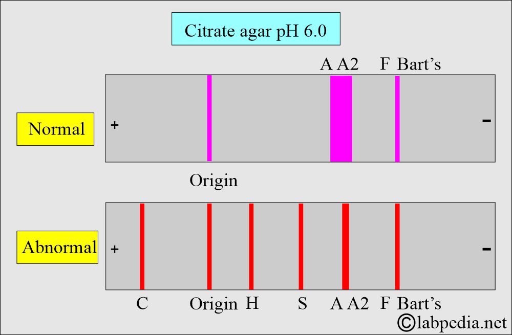 Hemoglobin (Hb) electrophoresis on citrate medium