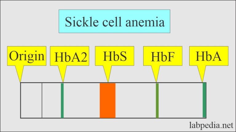 Hemoglobin Part 2 Hemoglobin Electrophoresis Hb Electrophoresis   Hb S Electrophoresis 768x430 
