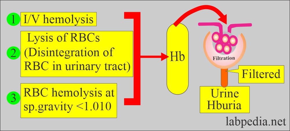 Hemoglobinuria causes