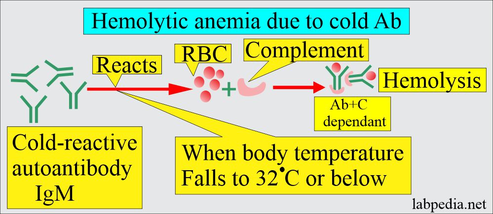 Hemolytic anemia due to cold Ab